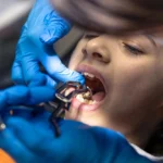 bonded retainer repair isle of man, broken bonded retainer, bonded retainer broken what to do, retainer repair, fixed retainer repair, bonded retainer came off, orthodontist retainer repair isle of man, Specialist bonded retainer repair Isle of Man at Isle of Man Orthodontics