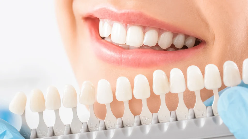 boutique teeth whitening isle of man, boutique whitening, teeth whitening isle of man, professional teeth whitening, boutique whitening reviews, home teeth whitening kit, boutique whitening how long does it last, best teeth whitening isle of man